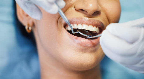 Best Urgent Care for Lost Fillings or Crowns in Lmer Heights, PA